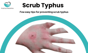 Important part of preventing scrub typhus 