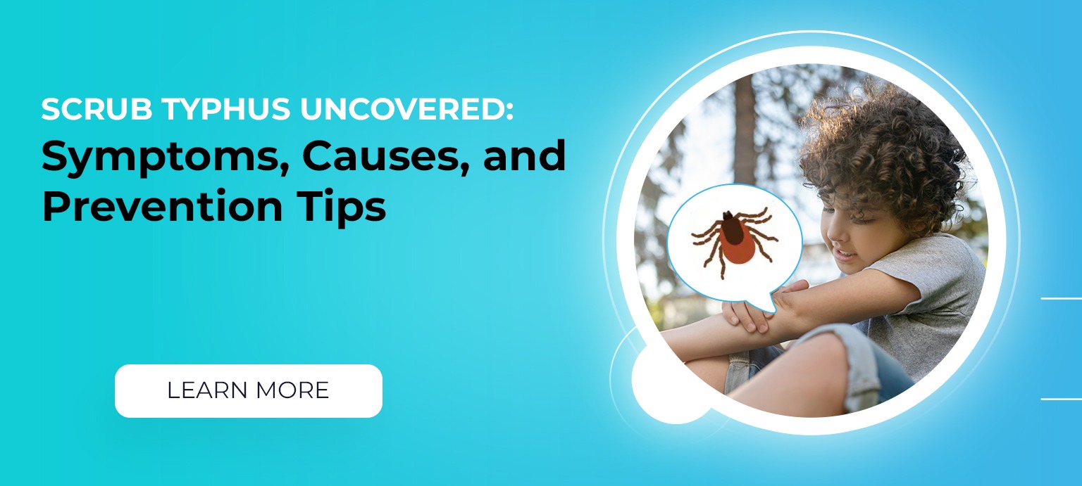 Scrub Typhus Uncovered: Symptoms, Causes, and Prevention Tips